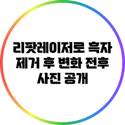 리팟레이저로 흑자 제거 후 변화: 전후 사진 공개