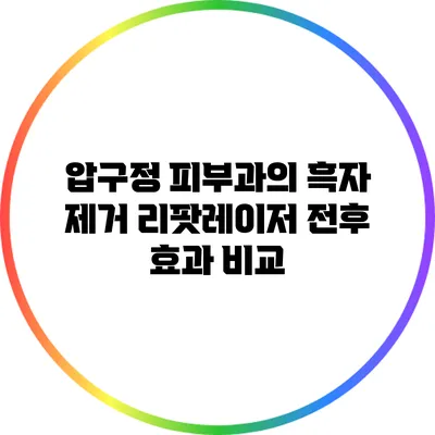 압구정 피부과의 흑자 제거 리팟레이저 전후 효과 비교