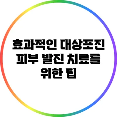 효과적인 대상포진 피부 발진 치료를 위한 팁